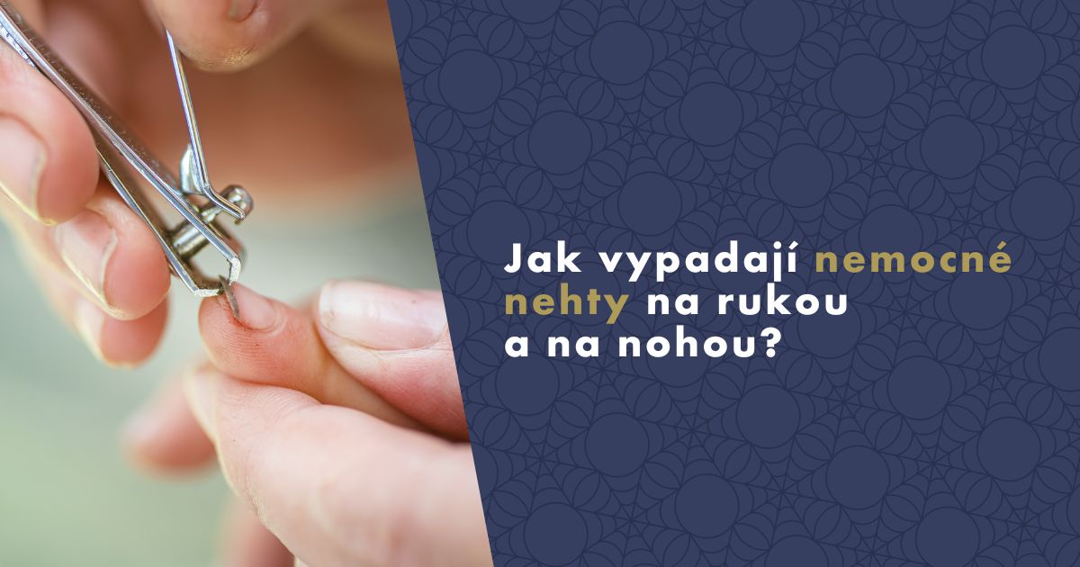 jak-vypadaji-nemocne-nehty-na-rukou-nohou-fb